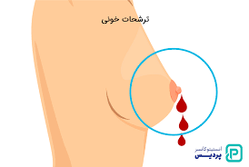 پاورپوینت تشخیص بیماری سرطان سینه با استفاده از تکنیک های داده کاوی