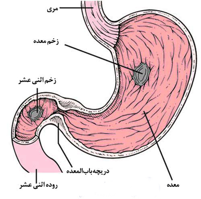 پاورپوینت کتاب برونر و سودارث گوارش