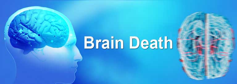 پاورپوینت Brain Death